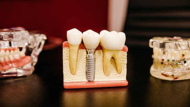Dental Surgery in Dahegam